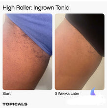 TOPICALS HIGH ROLLER Ingrown Tonic